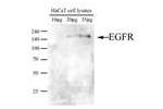 Anti-EGFR (clone AT2H8)