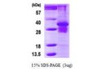 PSMB7, 44-277aa, Human