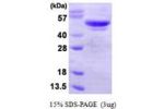 ATG4B, 1-393aa, Human