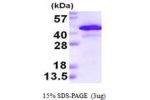 ADH1A, 1-375aa, Human