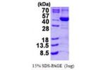 ALAD, 1-330aa, Human