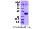 VPS25, 1-176aa, Human