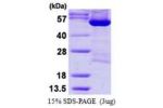 DARS, 1-501aa, Human