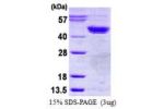 CSNK2A1, 1-391aa, Human