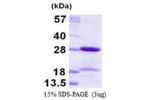 CBX5, 1-191aa, Human