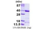 CCDC101, 1-293aa, Human