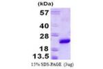 VPS29, 1-182aa, Mouse