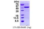 HIBCH, 33-386aa, Human