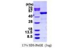 ARHGDIB, 1-201aa, Human, GST tag
