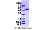 ADH5, 1-374aa, Human