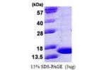 TNFa, 80-235aa, Mouse