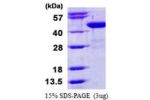BCAT1, 1-386aa, Human