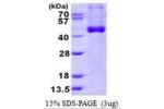 IL12P40, 23-328aa, Human, Baculovirus