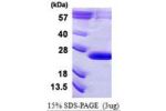 VPS29 1-182aa, Human