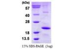 HSPB9, 1-159aa, Human