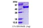 H5N1/HA, 17-338aa, Influenza A (H5N1), Baculovirus