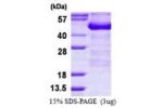 ADRM1, 1-407aa, Human
