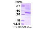 THAP1, 1-213aa, Human