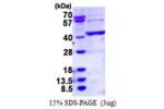 BCAT2, 28-392aa, Human