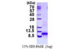 CXCL1, 25-96aa, Mouse