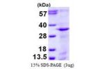STX12, 1-248aa, Human