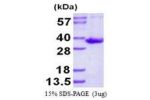 SULT1B1, 1-296aa, Human