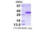 TATDN3, 1-274aa, Human