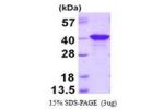 PQBP1, 1-265aa, Human