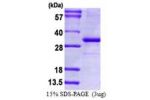 CD274, 19-238aa, Human