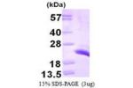 CETN1, 1-172aa, Human