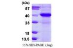ERCC1, 1-273aa, Human