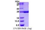 HPGDS, 1-199aa, Human