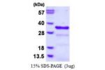 CHMP1B, 1-199aa, Human