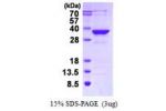 MMACHC, 1-282aa, Human