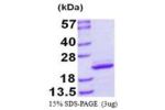 MYL12B, 1-172aa, Human