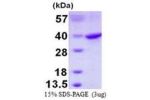 RPS3A, 1-264aa, Human