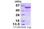 SIL1, 32-461aa, Human