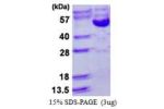 CCNB2, 1-398aa, Human