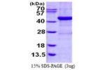 ADH1C, 1-375aa, Human