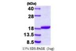 DSTN, 1-165aa, Human