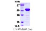 PDCL, 1-301aa, Human