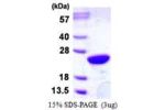 UBE2M, 1-183aa Human