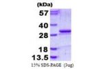 KLK5, 67-293aa, Human