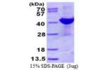 ADPRH, 1-357aa, Human