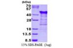 TTC1, 1-292aa, Human