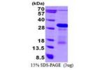 DBNDD1, 1-158aa, Human