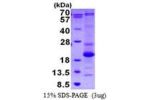 ASF1B, 1-202aa, Human