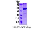 CD274, 19-239aa, Mouse