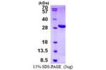 LYPLAL1, 1-237aa, Human