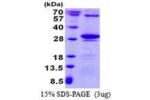 TK2, 34-265aa Human